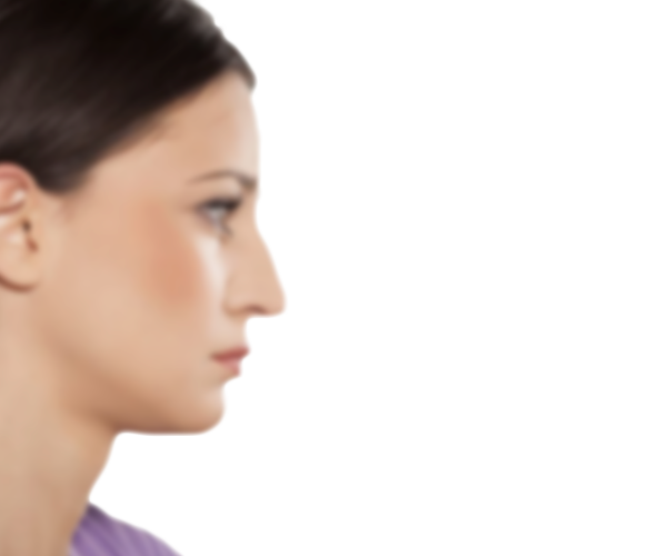 Antes de la rinoplastia